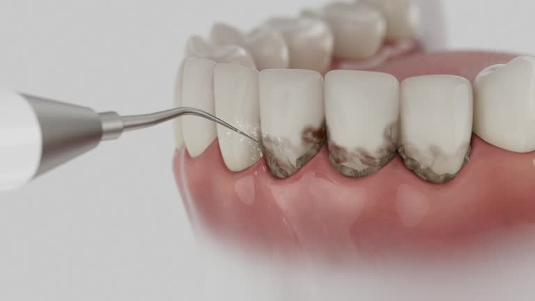 Reliable Dental contractor in Meridian Hills, IN by Dentist Open Now